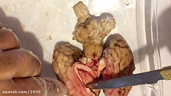 تشریح مغز گوسفند در خانه - قسمت اول