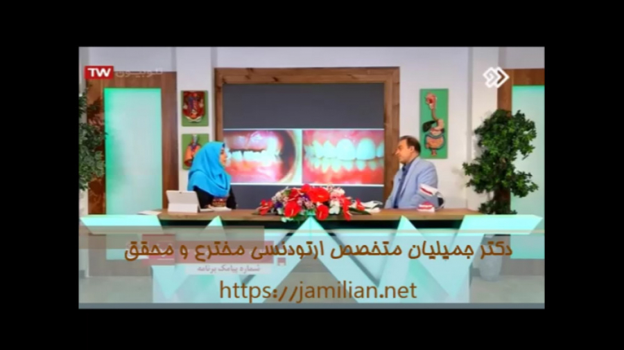 درمان ارتودنسی برای بستن فضاهای کوچک / متخصص ارتودنسی / دکتر جمیلیان دکتر عبدالرضا جمیلیان - متخصص ارتودنسی