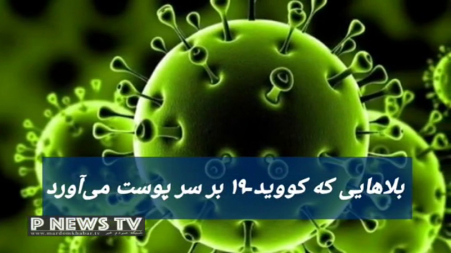 بلاهایی که کووید-۱۹ بر سر پوست می آورد