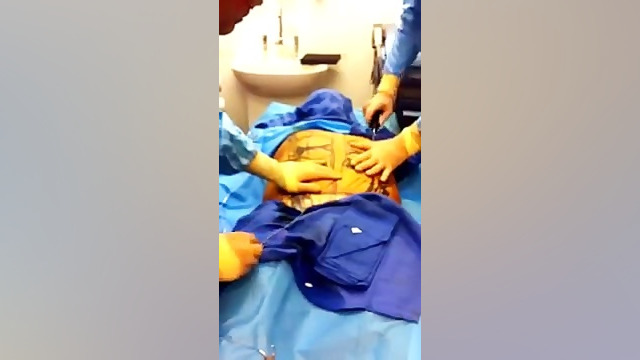 لیپوماتیک 4 ایم‌دولیموماب