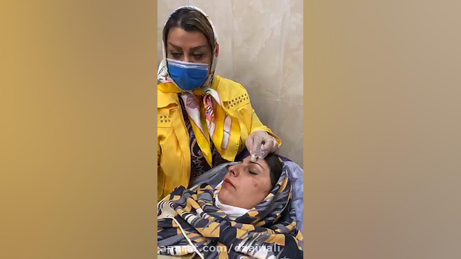 رفع کک و مک و بوتاکس دکتر فرحناز زینعلی - متخصص پوست، مو، زیبایی زنجان