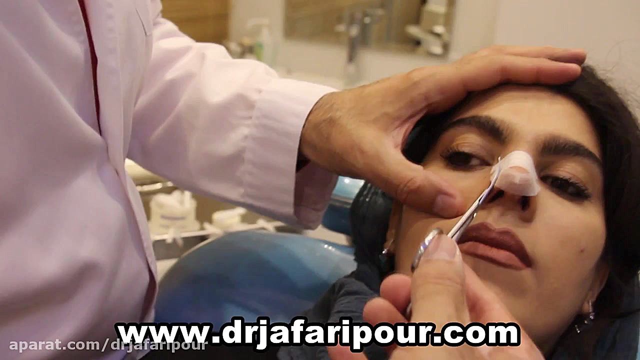 چسب زدن بینی پس از جراحی زیبایی بینی دکتر مسعود جعفری پور