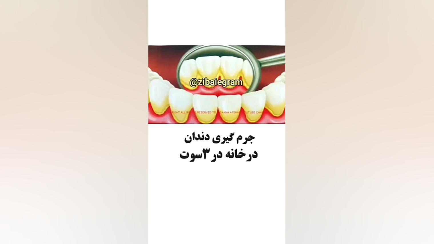 جرم گیری آسان‌ دندان در خانه بیوسنسور لاکتات خون