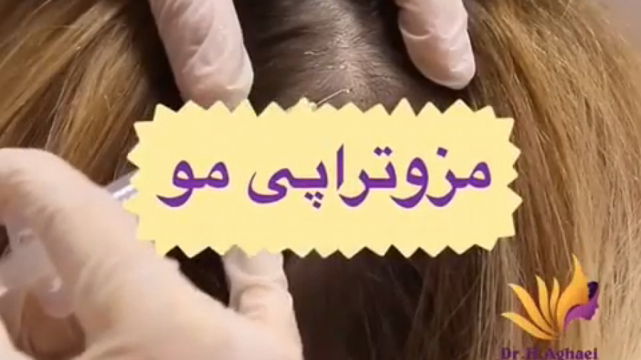 فیلم واقعی مزوتراپی مو دکتر حمیده آقایی