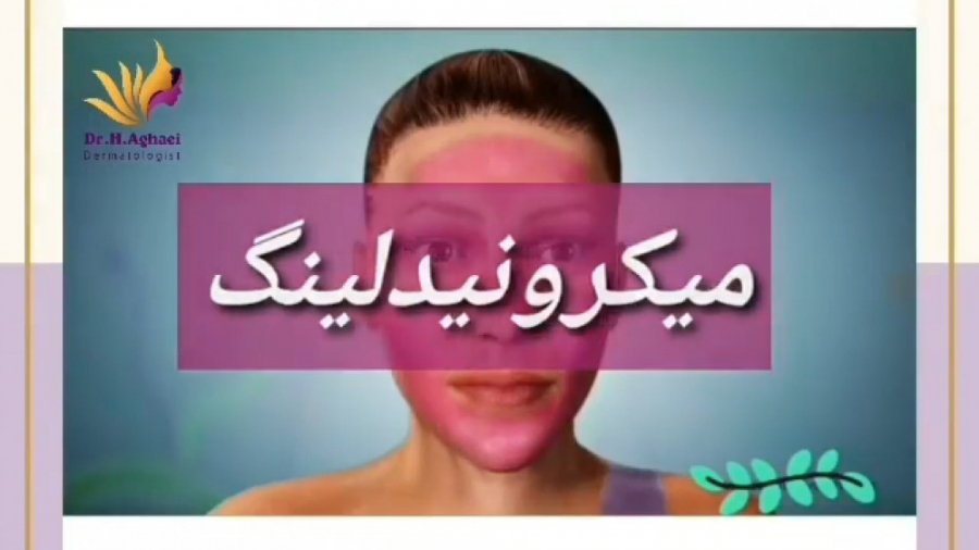 ویدیوی جالب از میکرونیدلینگ دکتر حمیده آقایی
