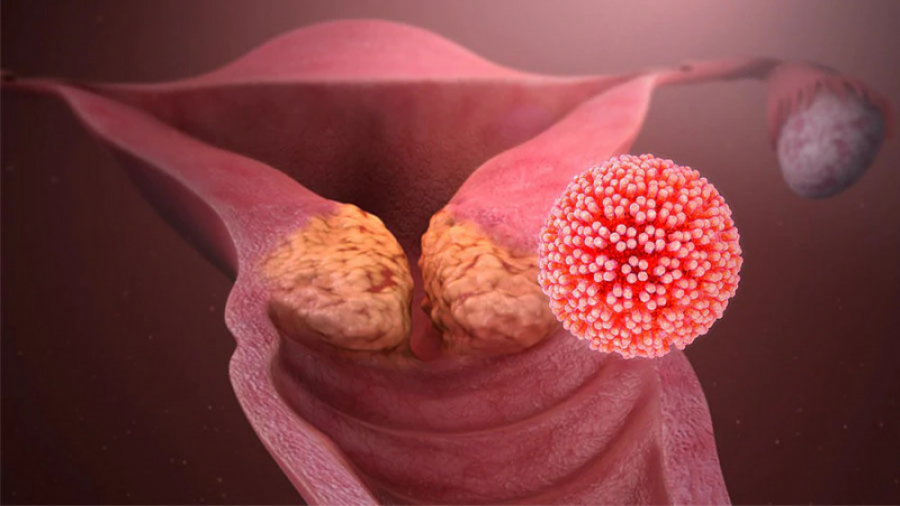 تشخیص سرطان دهانه رحم عمل زیبایی