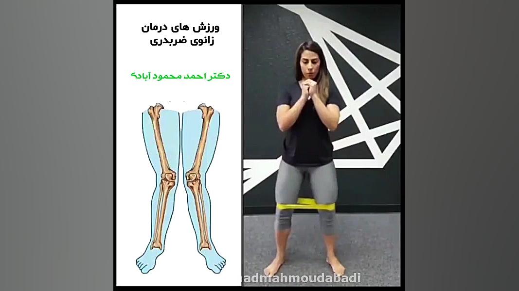 ورزش برای درمان زانوی ضربدری دکتر احمد محمودابادی