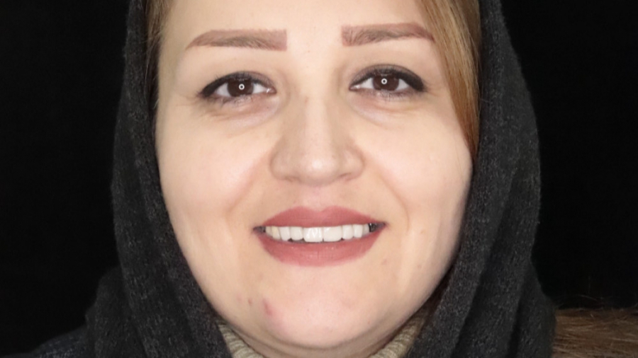 اصلاح خط لبخند کلینیک دندانپزشکی موذن