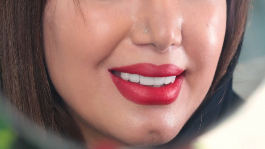 روکش زیرکونیا کلینیک دندانپزشکی موذن