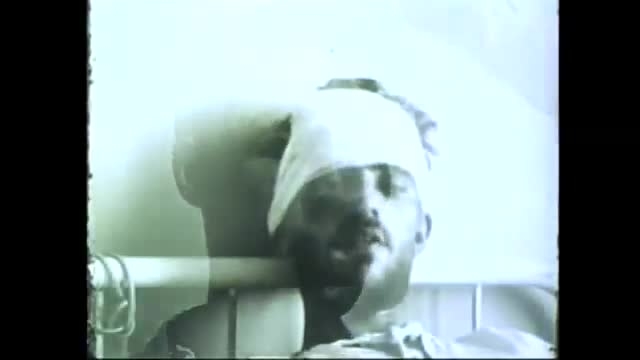 بیماری ترسناک هاری!! ایربسارتان