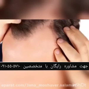 رویش مجدد مو بدون نیاز به کاشت