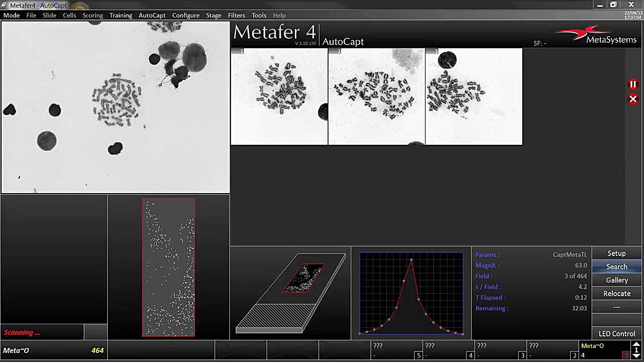 AutoCapt - Automated Image Acquisition with Metafer هیدروپس فتالیس