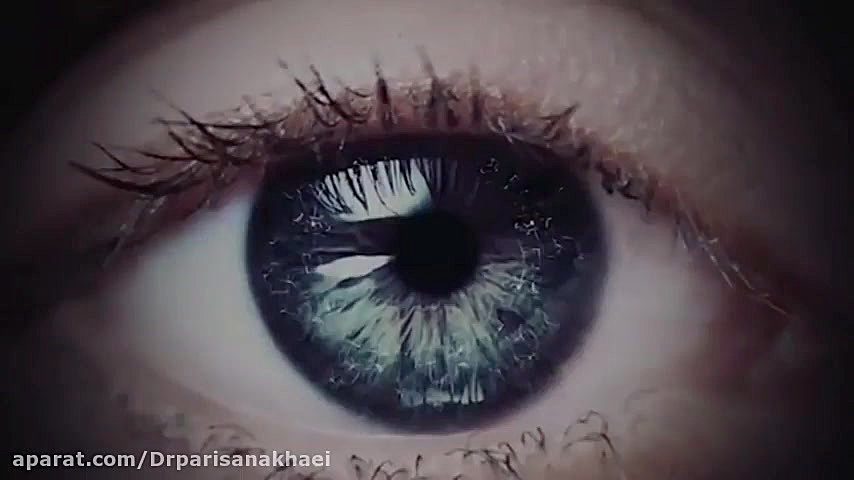 فیلم واقعی جراحی لازک چشم نپتوکلیب