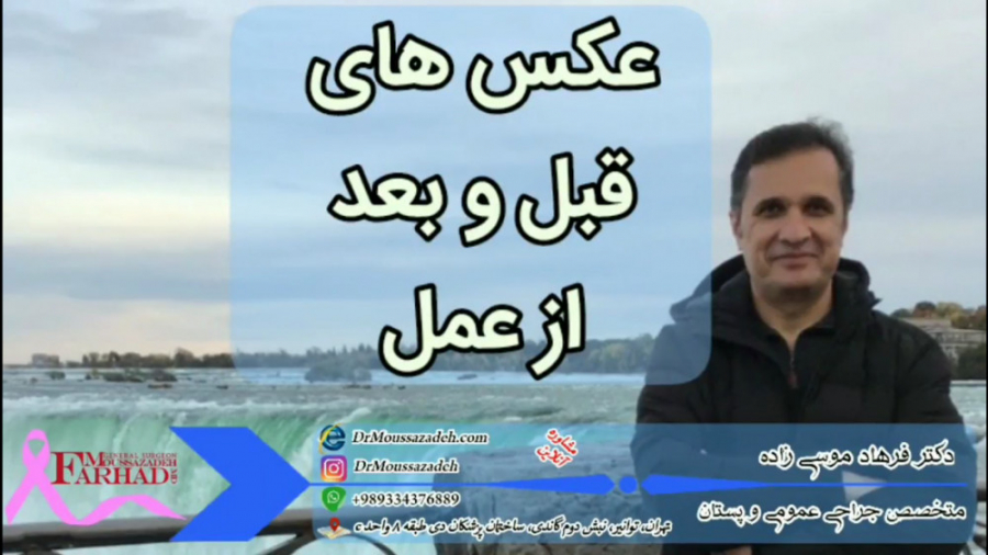 عکس های قبل و بعد از عمل پرتاب نعل
