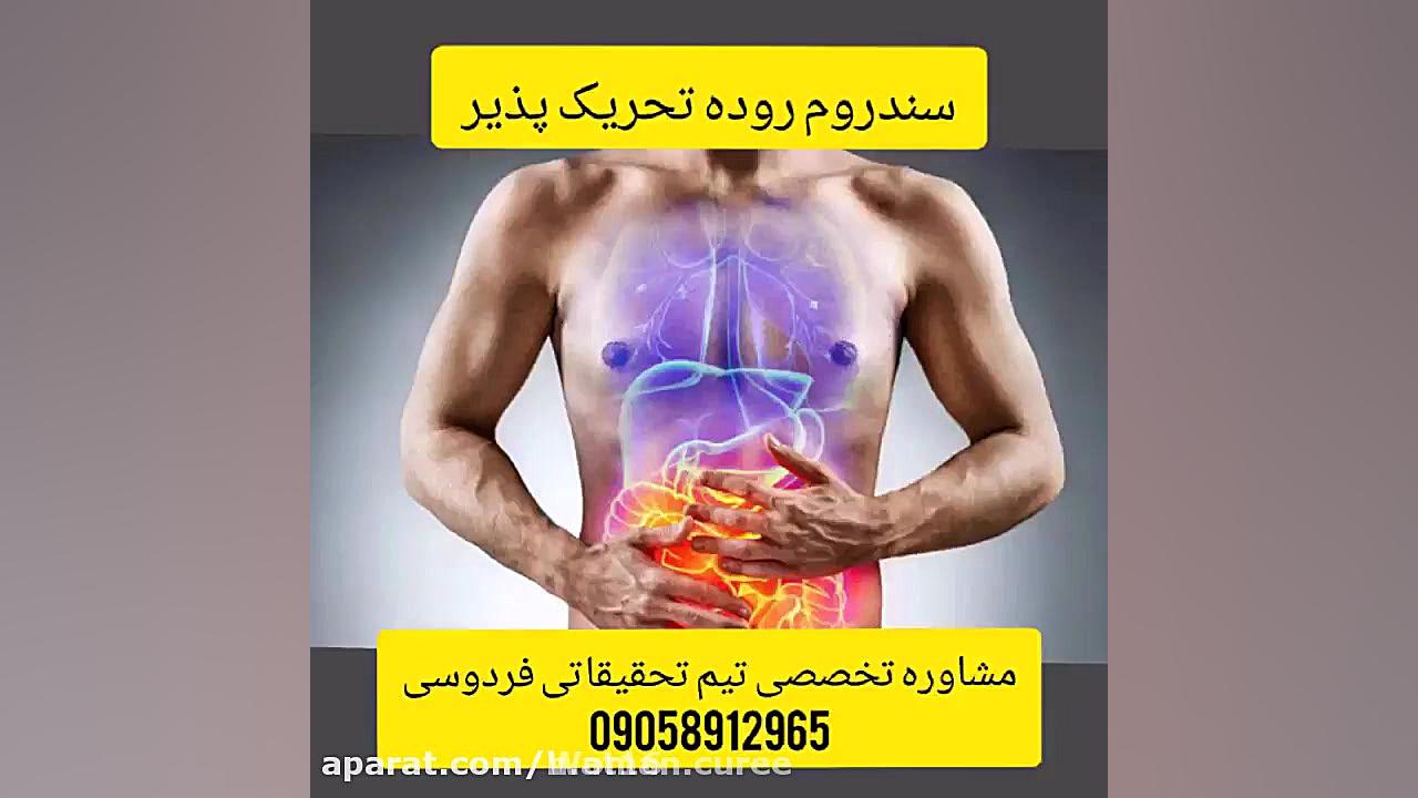 ارائه جدید ترین راهکار درمانی سندروم روده تحریک پذیر انیدروز