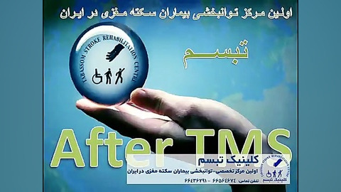 تی ام اس تراپی -توانبخشی بیماران سکته مغزی- کلینیک تبسم ترمیم ونیر