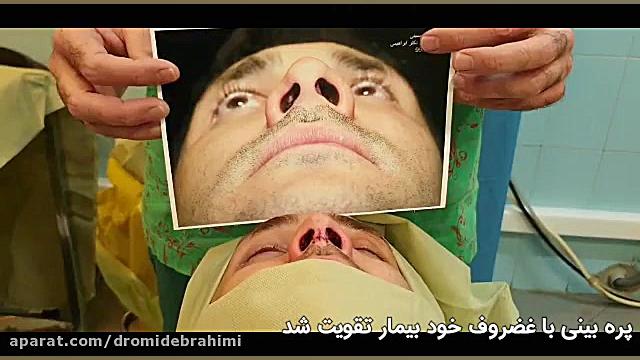 عمل ترمیمی بینی توسط دکتر امید ابراهیمی بهترین جراح بینی ترمیمی در تهران دکتر امید ابراهیمی