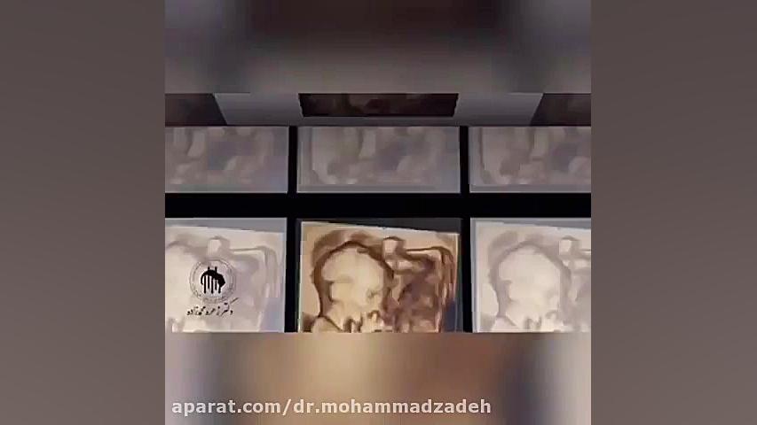 تعدادی از نمونه کار های سونوگرافی سروش اینسایزینگ