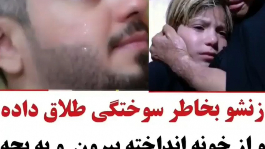 زنشو بخاطر سوختگی طلاق داده جراحی لثه