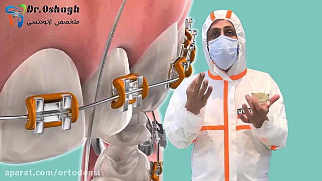 نخ دندان فراموش نشود دکتر مرتضی عشاق متخصص ارتودنسی