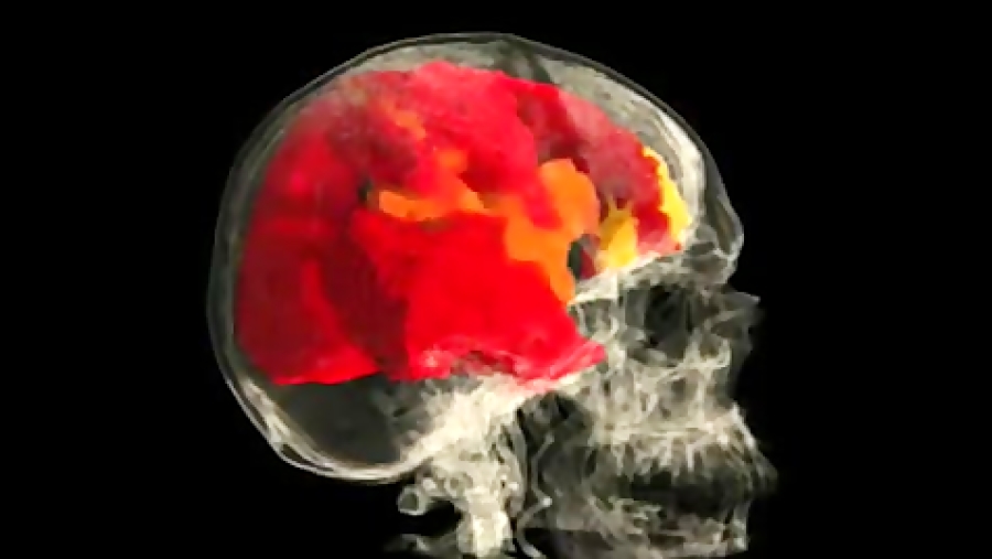 نگاهی به مغز یک خانم در هنگام ارگاسم در زیر دستگاه MRI گیم‌پلی کله‌خراب