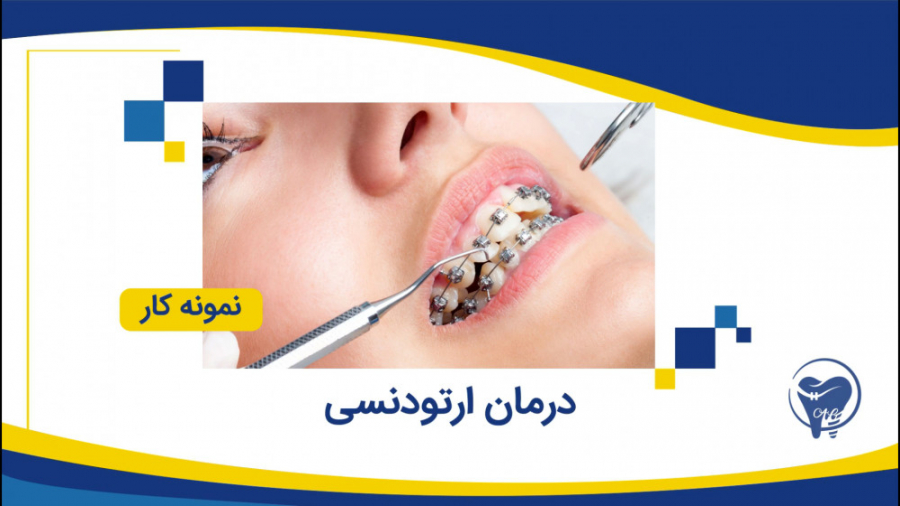 نمونه کار - درمان ارتودنسی کلینیک دندانپزشکی دکتر عزیز گشاده رو