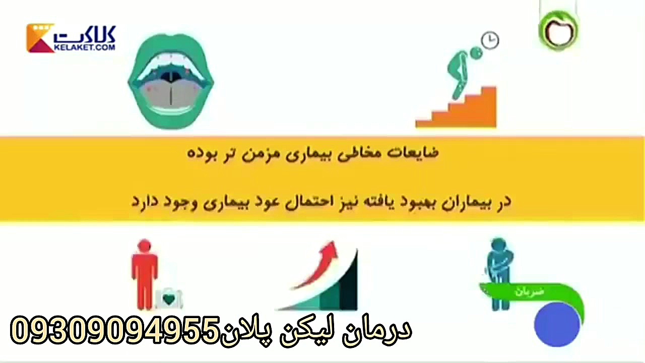 راه درمانی لیکن پلان (خزه پوستی) جراحی زیبایی پلک