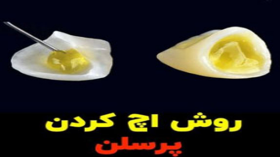روش اچ کردن پرسلن تست تنفس اوره C13