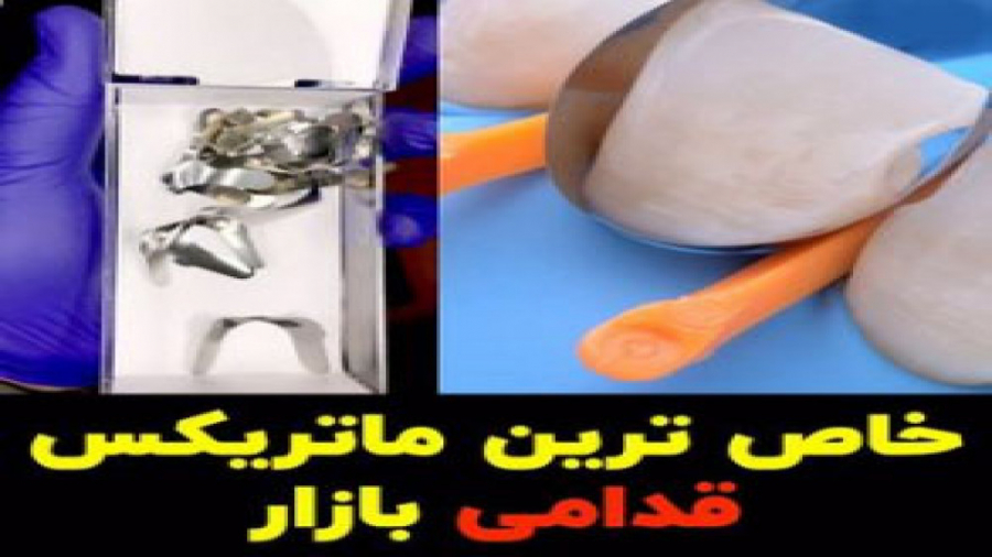 خاص ترین ماتریکس قدامی بازار بیماری آلبومینوری وراثتی