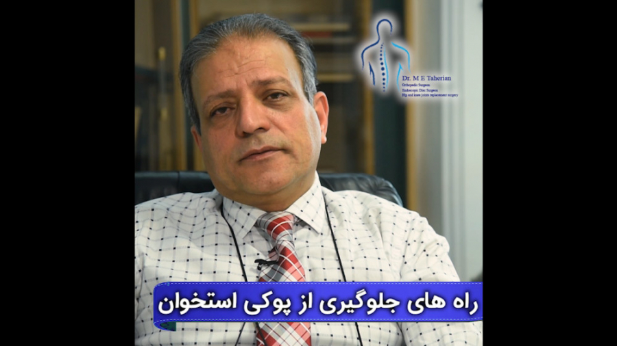 راه های جلوگیری از پوکی استخوان لیفت پیشانی
