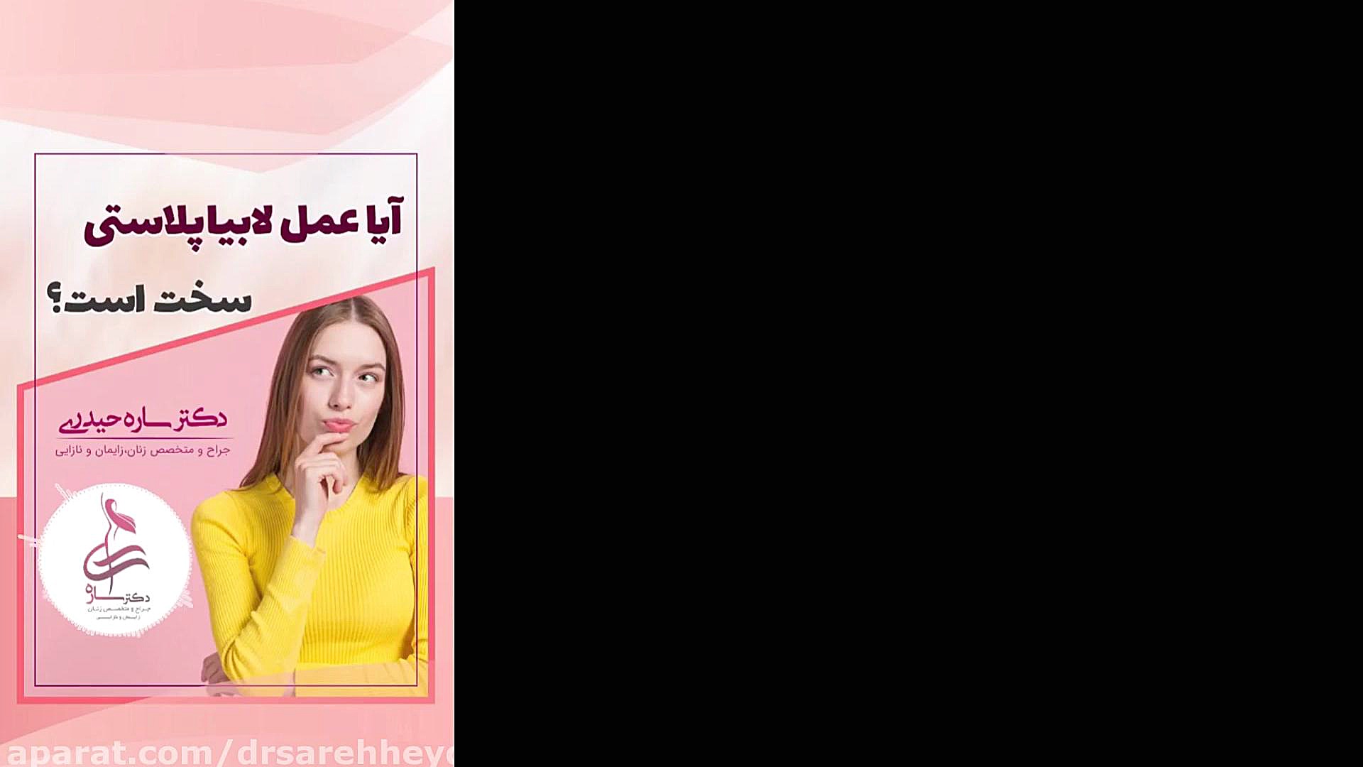 آیا لابیاپلاستی سرپایی است؟ زاویه سازی صورت