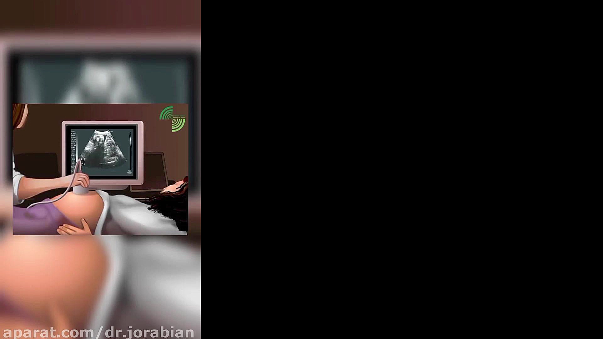 فیلم سونوگرافی دوران بارداری با توضیحات دکتر جورابیان لیزر صورت