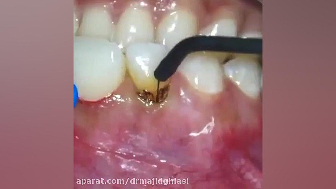 اصلاح طرح لبخند دکترمجیدقیاسی