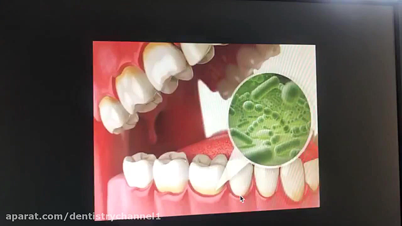 وبينار سمپوزيوم پريو بخش دوم ( دکتر پزشک فر و دکتر دل آرام نيکو و دکتر صادقي ) Fluorescence Lifetime Imaging