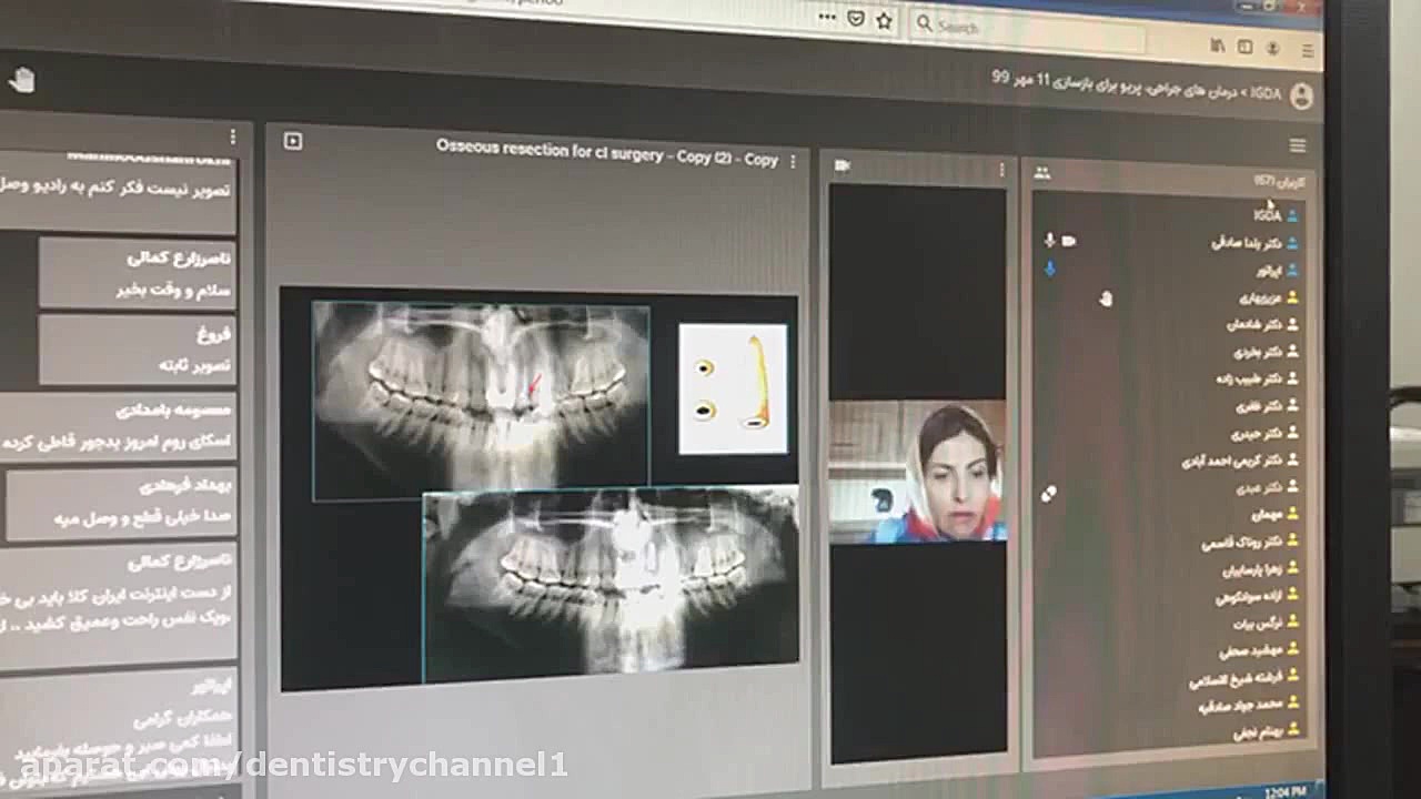 وبينار سمپوزيوم پريو بخش پنجم ( دکتر پزشک فر و دکتر دل آرام نيک و دکتر صادقي ) میکروسفالی
