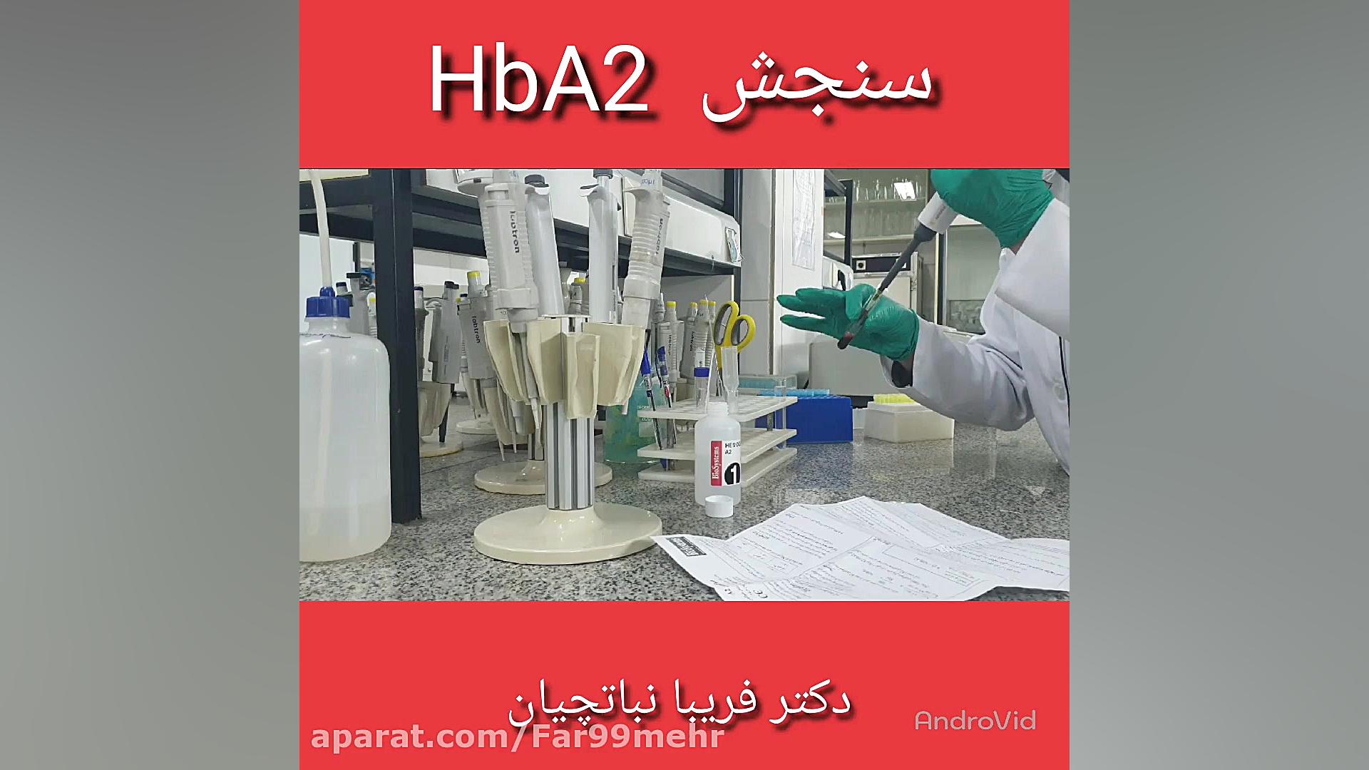 اندازه گیری هموگلوبینA2 هالوسیناتوری بویایی