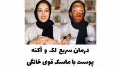 درمان سریع  لک  و  آکنه پوست با ماسک قوی خانگی