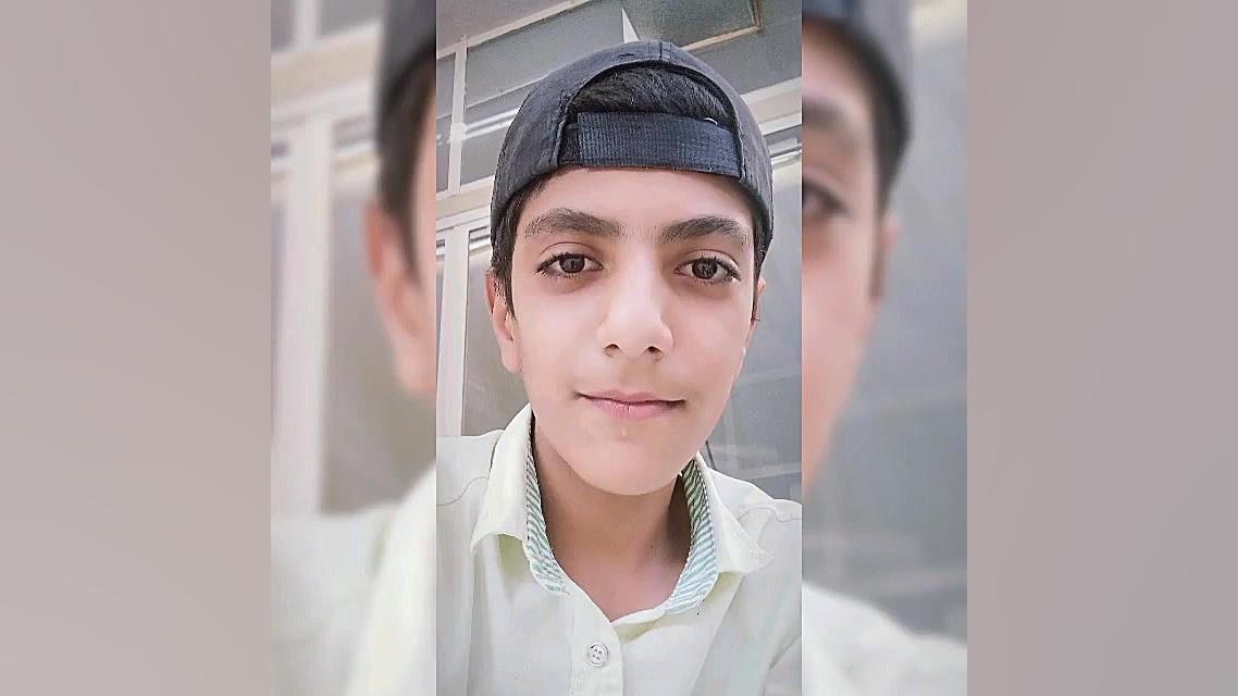 امیر حسین قندی زفره ای رفع افتادگی پلک