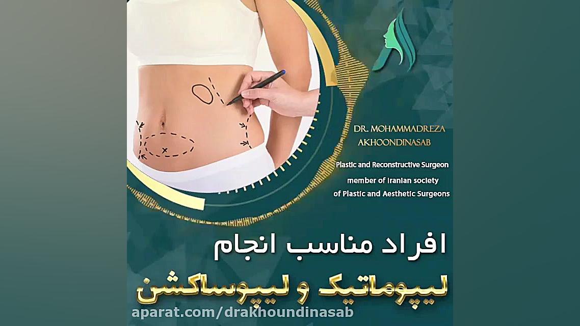 صحبت دکتر آخوندی نسب درباره افراد مناسب برای انجام لیپوماتیک و لیپوساکشن دکتر محمدرضا آخوندی نسب-فوق تخصص جراحی پلاستیک