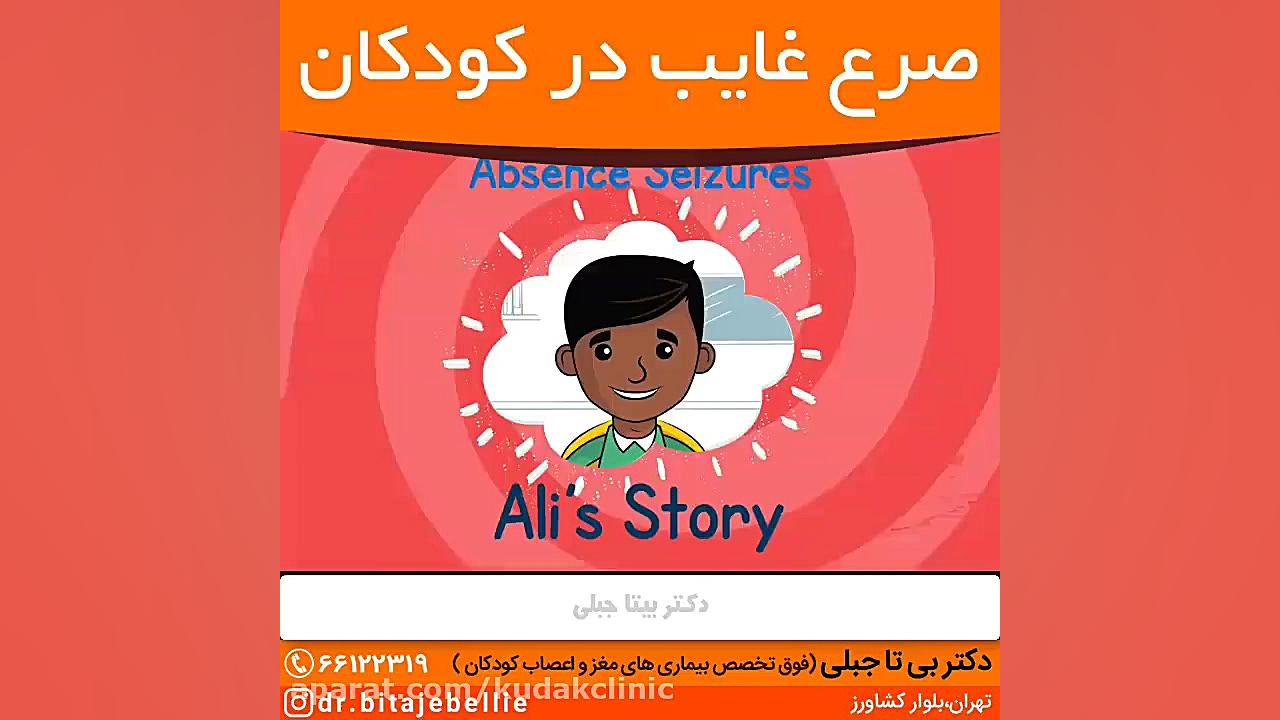 صرع غایب در کودکان ماموپلاستی