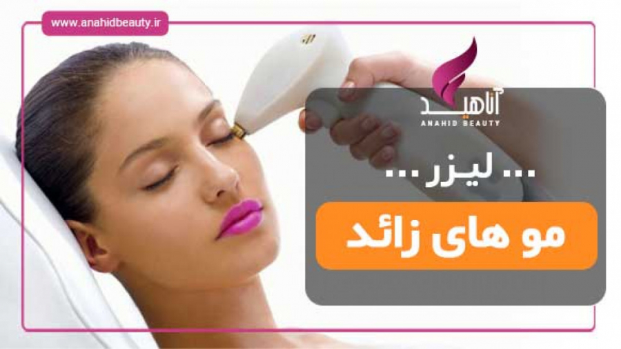 لیزر مو های زائد صورت دندان شیری