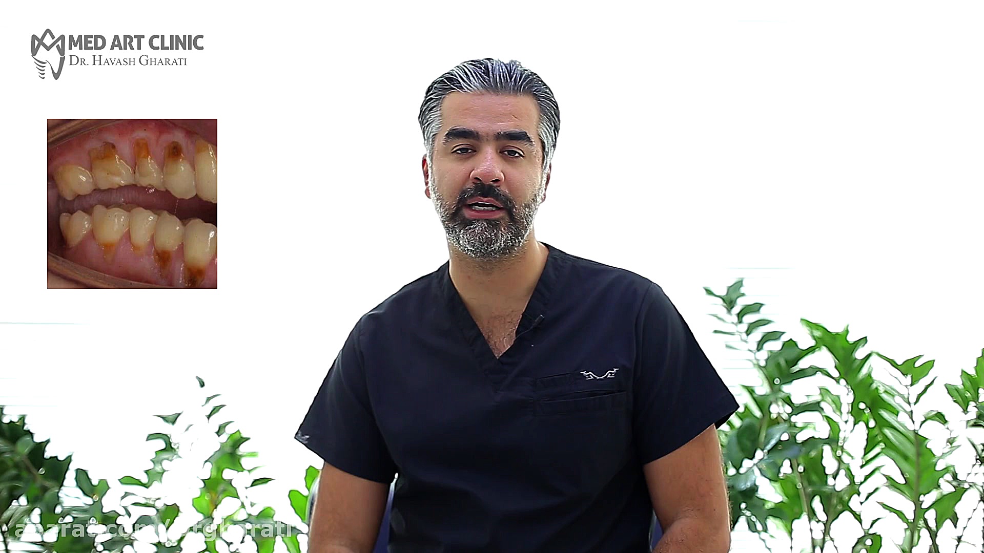 آموزش بهداشت - قسمت سوم - انتخاب خمیردندان مناسب دکتر هاوش غارتی