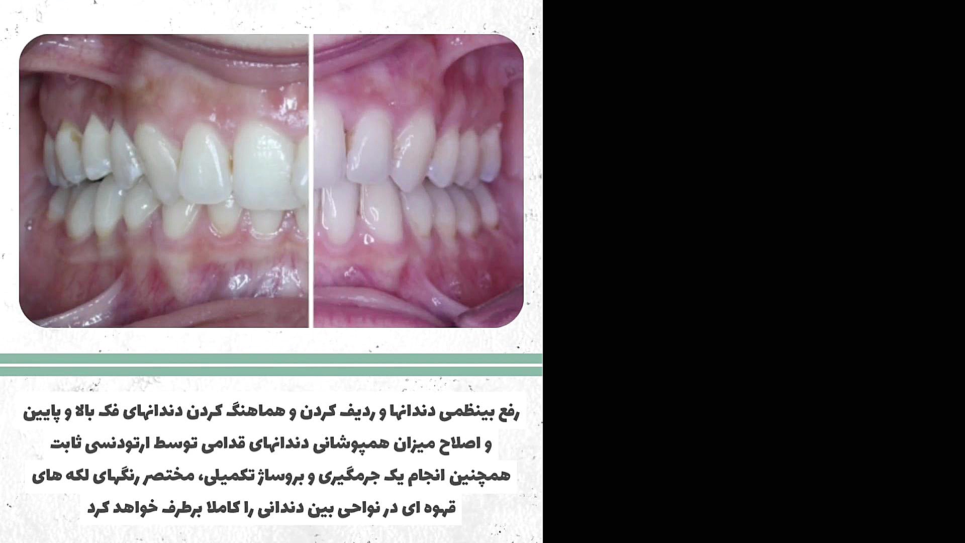 ارتودنسی دکتر سعید فروغی متخصص ارتودنسی