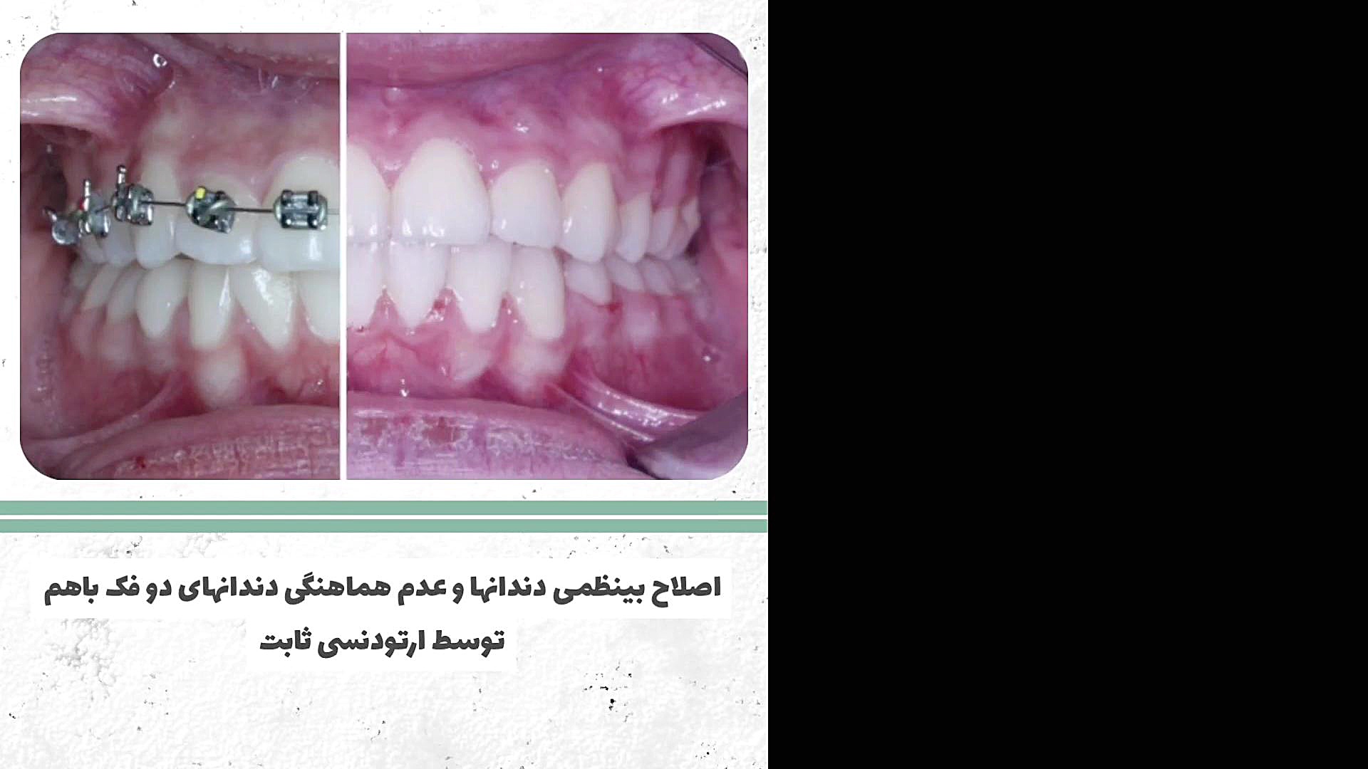 ارتودنسی دکتر سعید فروغی متخصص ارتودنسی