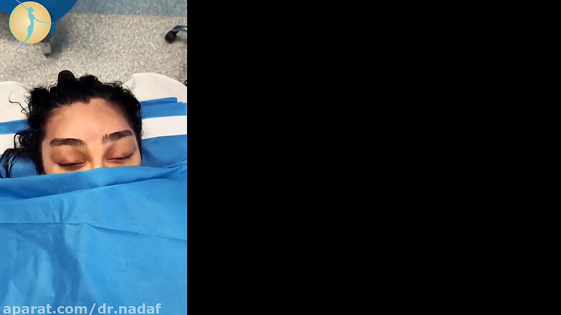چهره ای جوان تر با لیفت ابرو زاویه سازی صورت