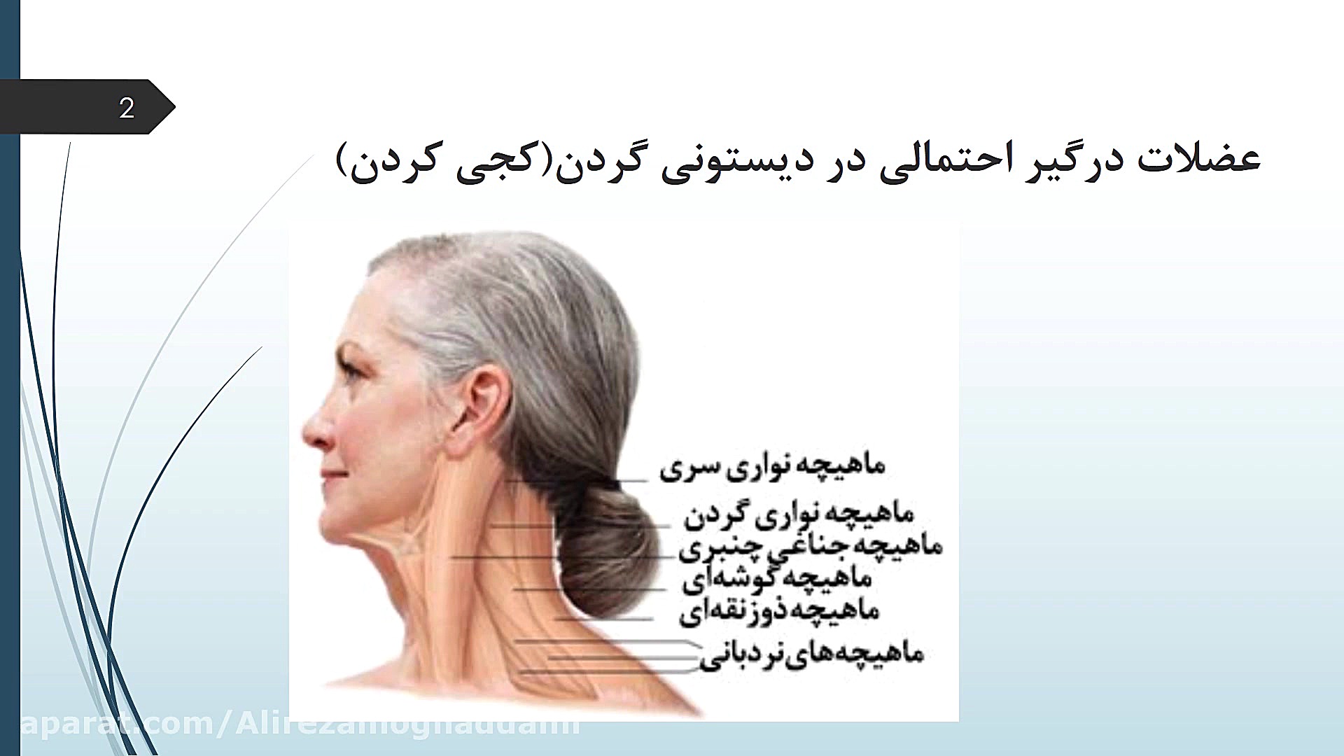 کجی گردن و سر هایفوتراپی