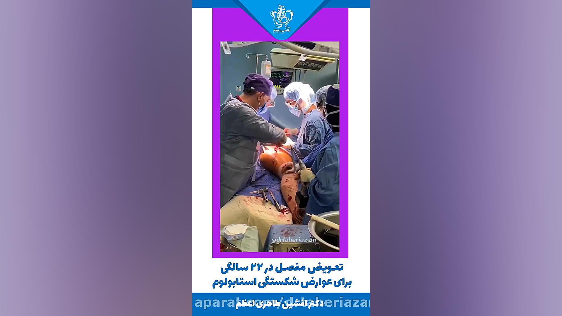 تعویض مفصل لگن(ران) در سن 22 سالگی برای شکستگی استابولوم دندانپزشک زیبایی