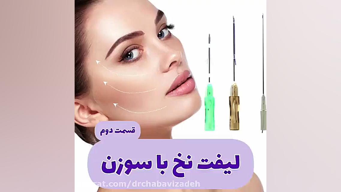 فیلم واقعی لیفت صورت با نخ - پارت دوم دکتر صفیه چعباوی زاده