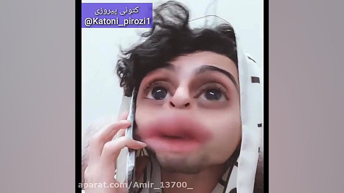 فردین جهانشیری. دیسمورفی فاسیال