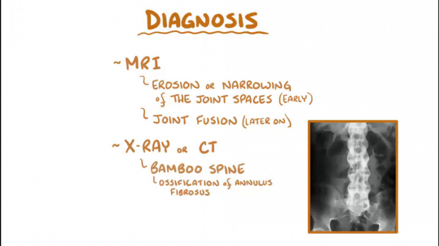 روماتولوژی اسموزیس با دوبله فارسی(مبحث اسپوندلیت آنکیلوزان ) تزریق ژل